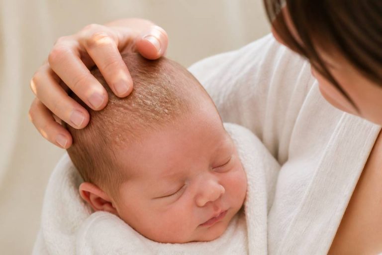 Croûte de lait et lait maternel : ce qu’il faut savoir pour prendre soin du cuir chevelu de bébé